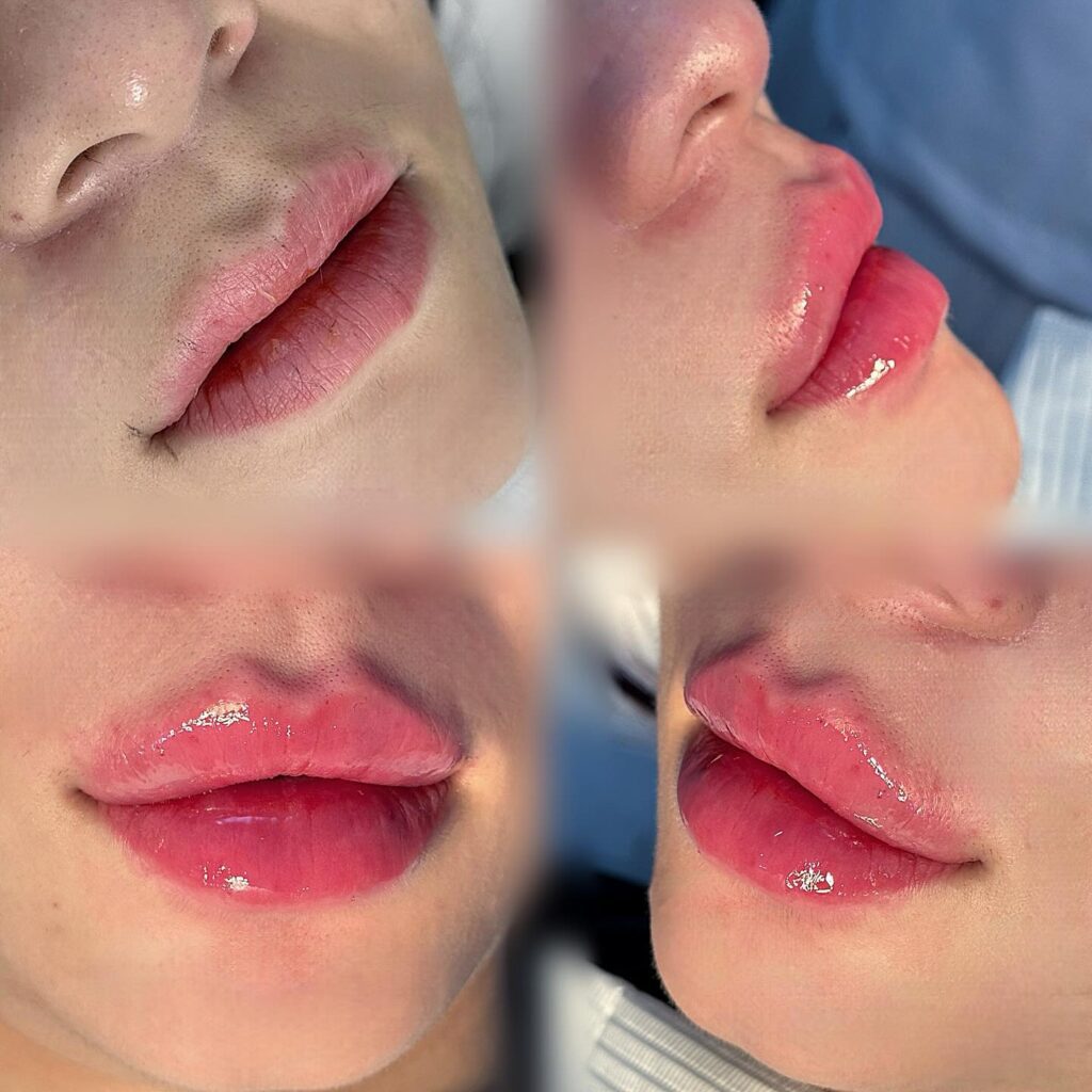  Pillow Lips (Fluffy Russian)