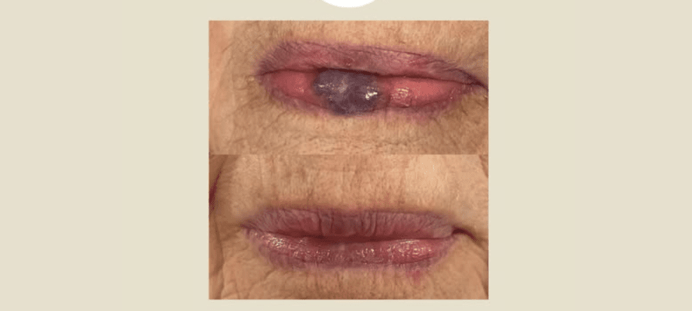  Dark Purple Development