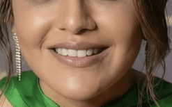 Green Phase (Biliverdin Formation)