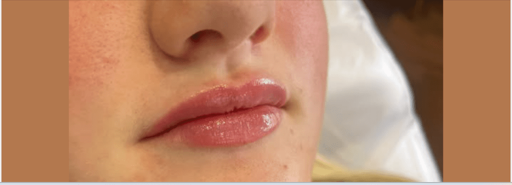 The Immediate Aftermath & Inflammation