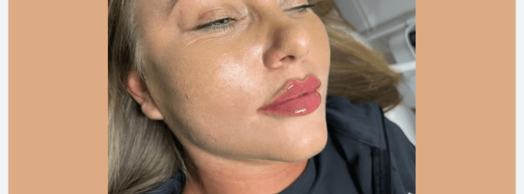 The Peak Swelling Phase