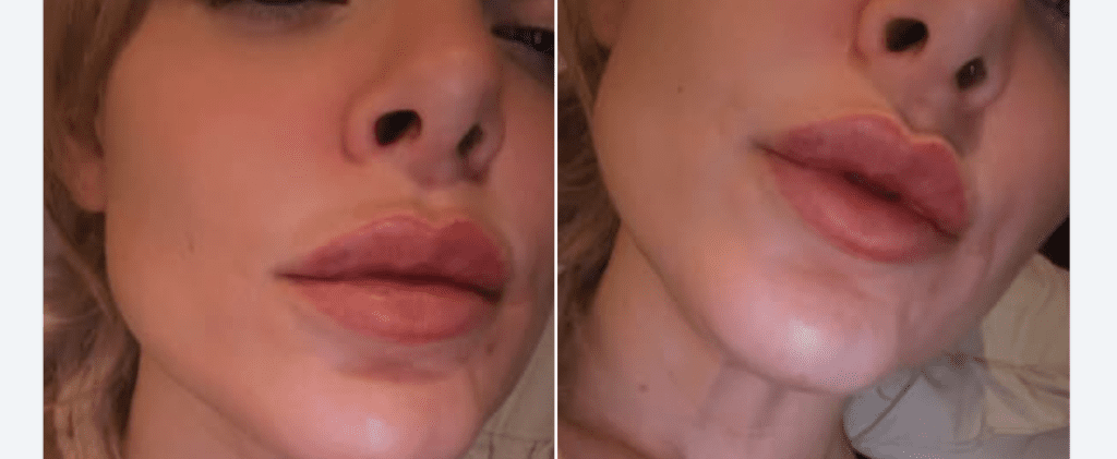 Beautiful Shape in one week