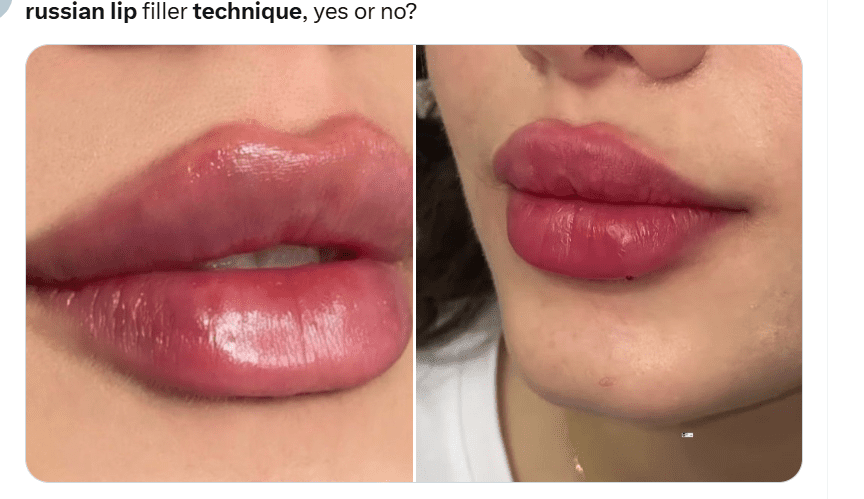 The Russian Lip Technique