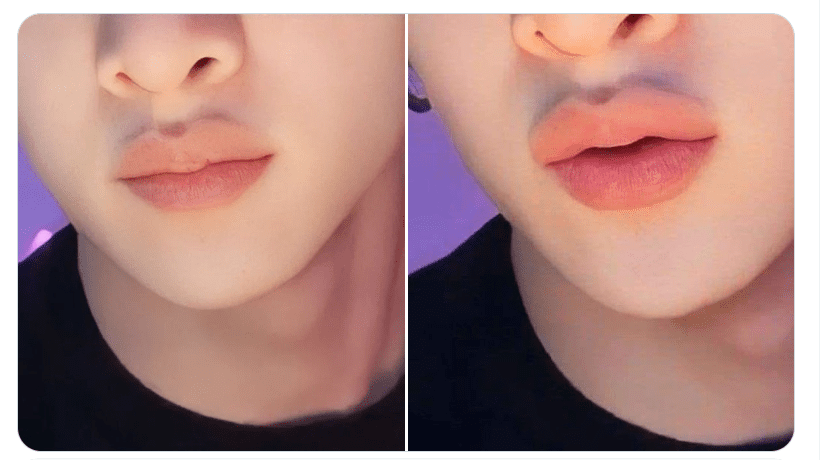 The "Zoom Effect" and Professional Confidence