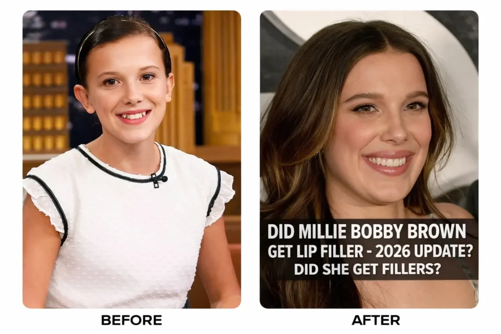 Did Millie Bobby Brown Get Lip Filler 2026 Update
