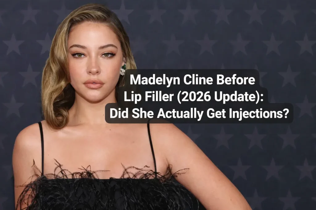 Madelyn Cline Before Lip Filler (2026 Update): Did She Actually Get Injections?