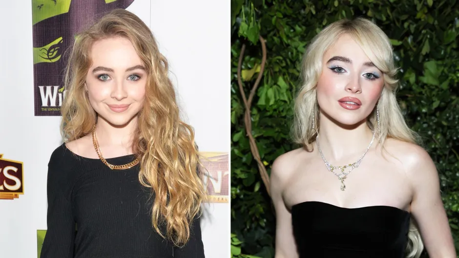 Sabrina Carpenter Lip Filler (2026 Update)