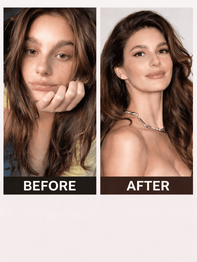 Camila Morrone Before Lip Filler (2026 Update)